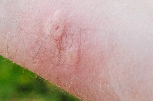 are jumping spiders dangerous