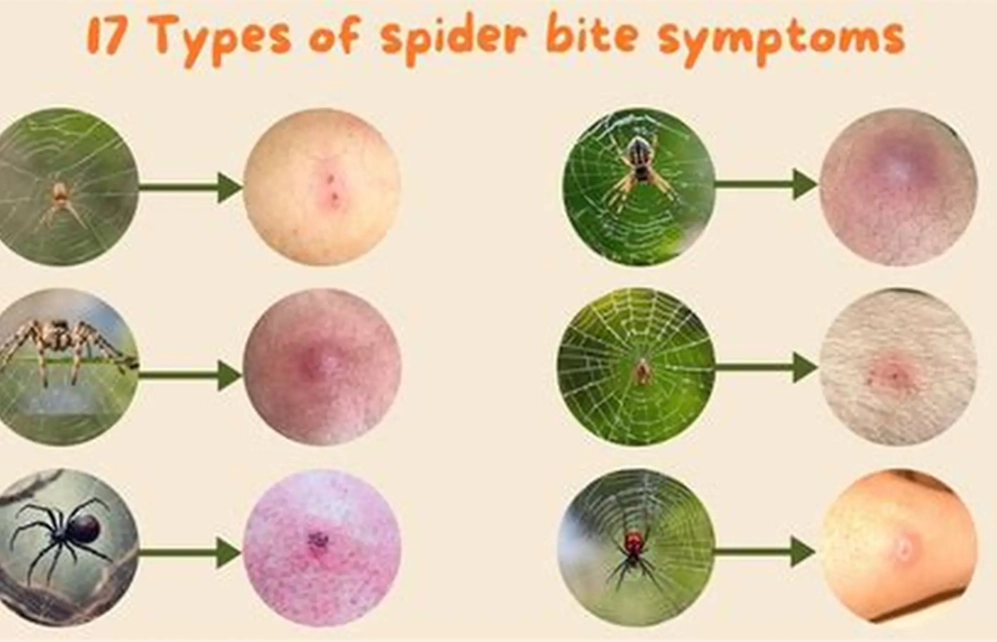 are bedroom spiders dangerous