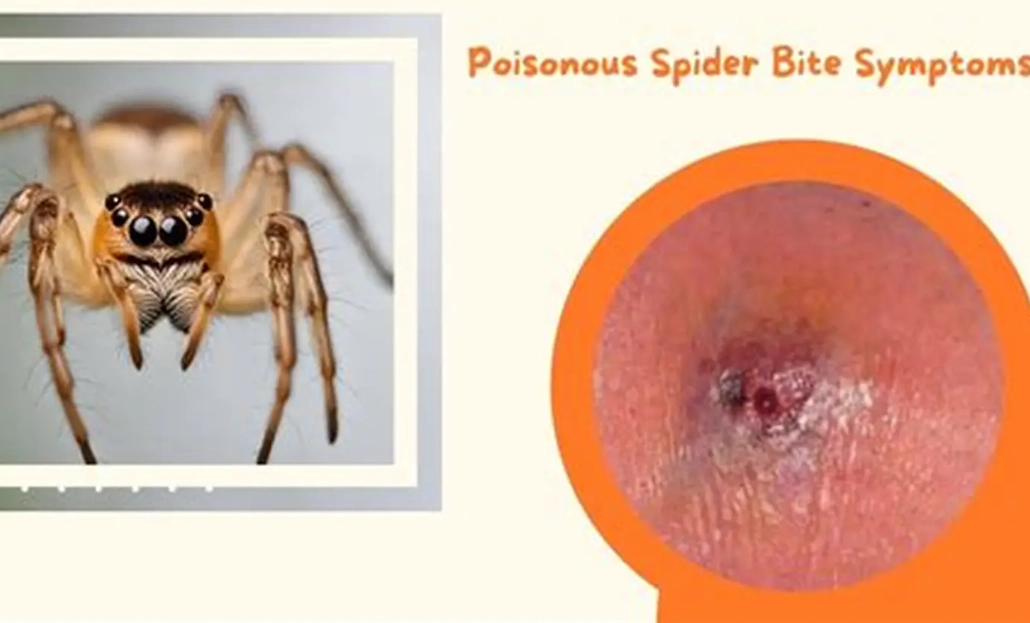 are bedroom spiders dangerous