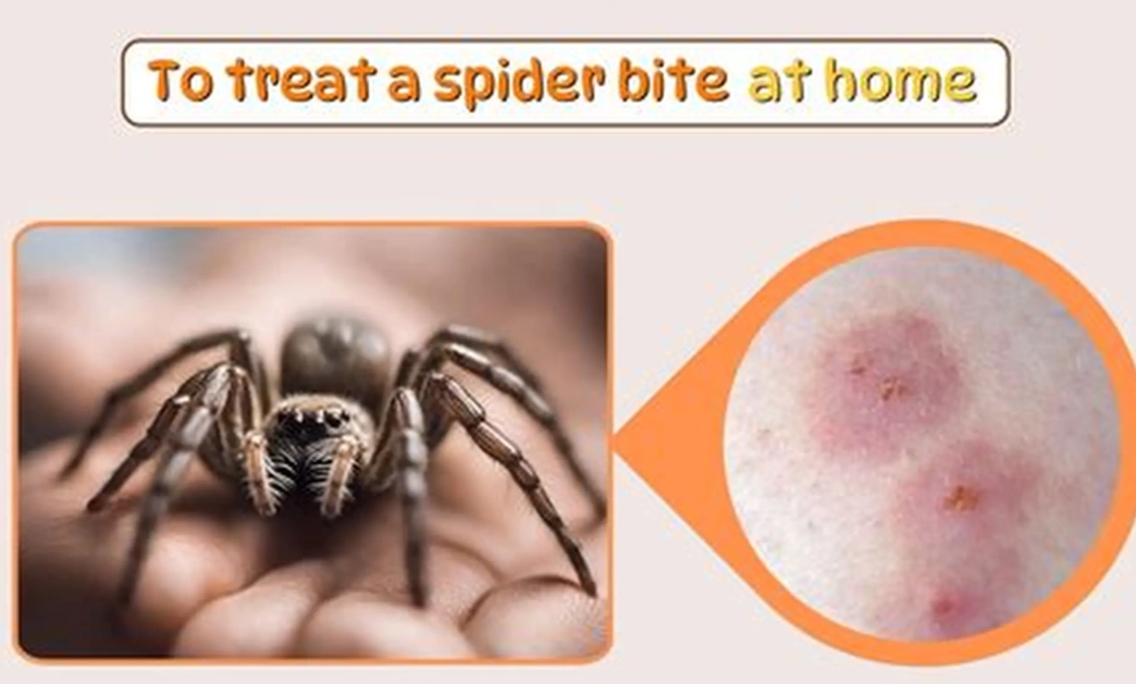 bedroom spider bite symptoms