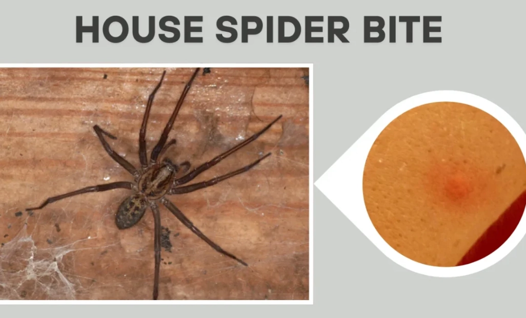 Bedroom Spider Bites: Identification, Risks & How to Treat Them Safely
