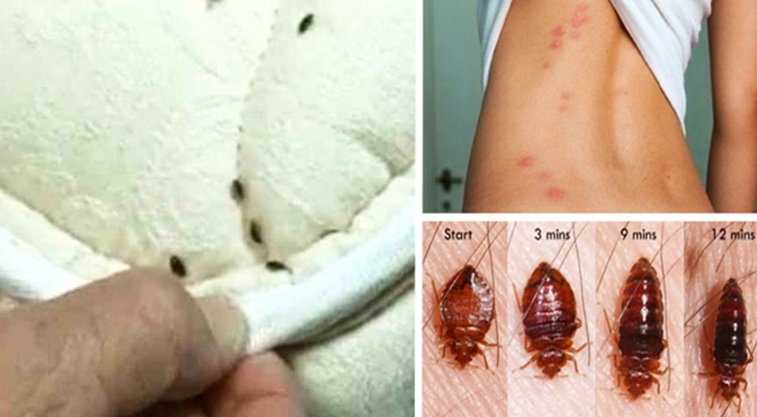 How You Get Bed Bugs & How to Avoid Them