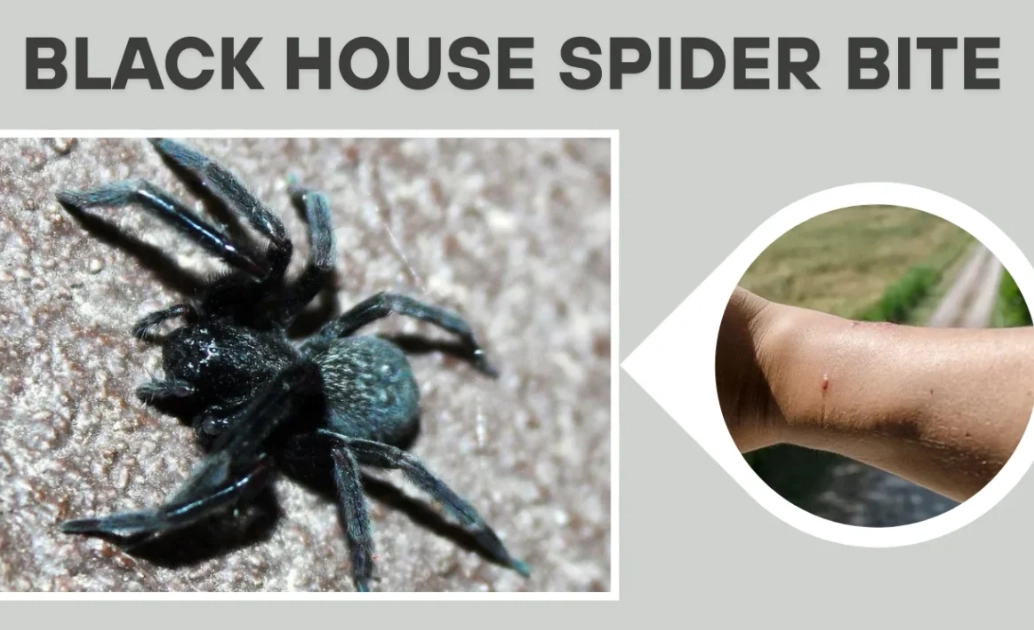 black house spider bite