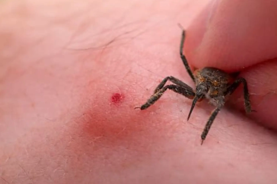 assassin bug bite treatment