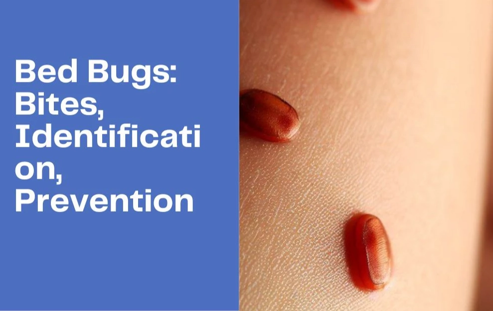 bed bug bites