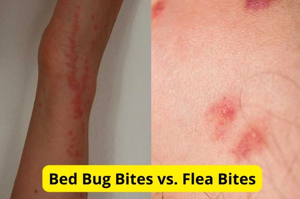 bed bug infestation