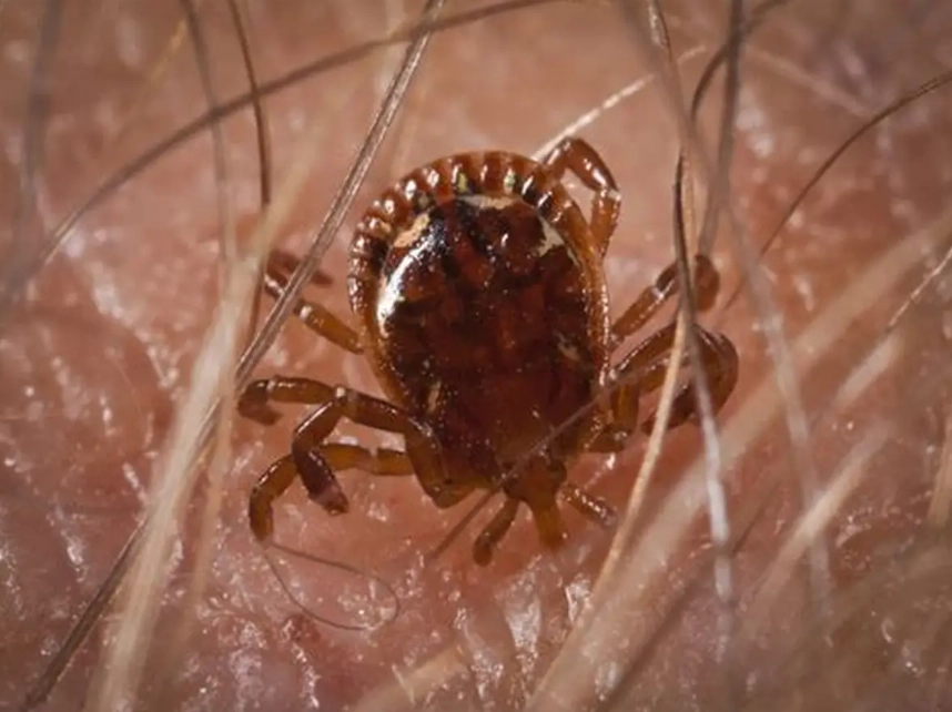 dog tick diseases