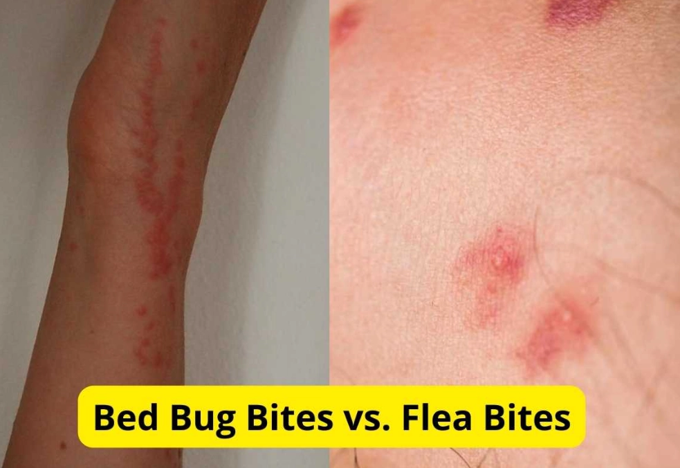 bed bug flea bites on humans