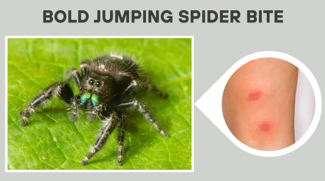 jumping spider bite symptoms
