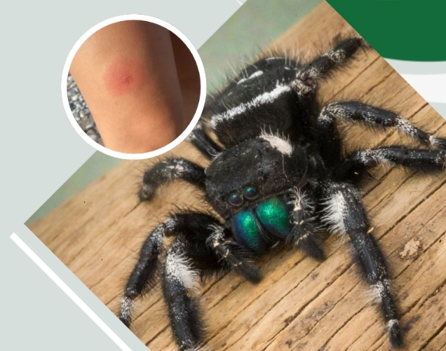 jumping spider bite symptoms