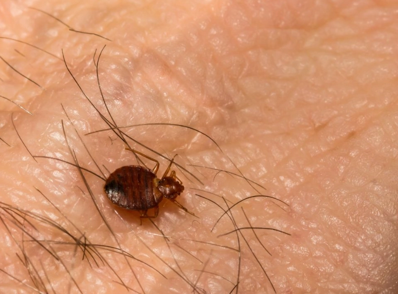 flea bites