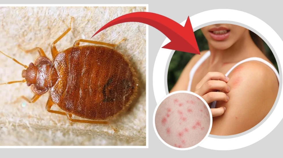 bed bugs