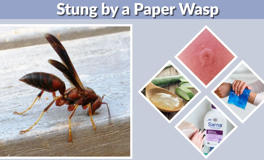 how to treat a paper wasp sting