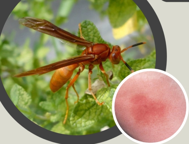 paper wasp sting