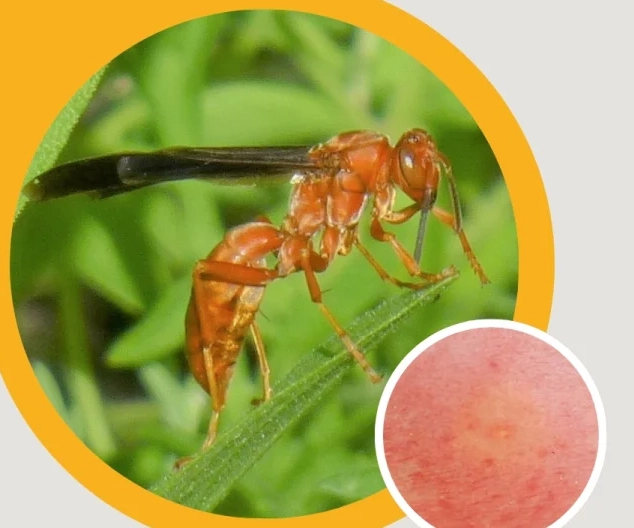 paper wasp sting treatment