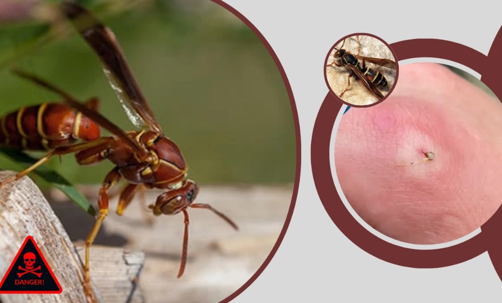 how to treat a paper wasp sting